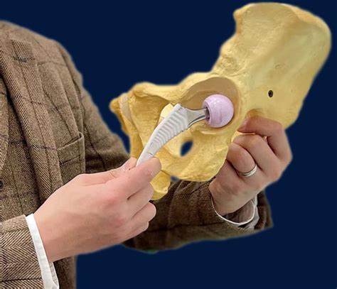 hip replacement greenwich|Private hip replacement in Norwich, near Norfolk .